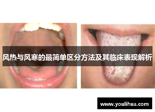 风热与风寒的最简单区分方法及其临床表现解析 风热与风寒的最简单区分方法及其临床表现解析
